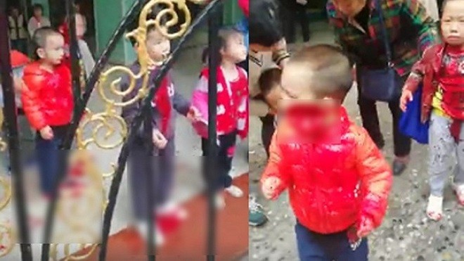 突發：重慶紅衣女闖幼稚園 亂刀砍傷14幼童
