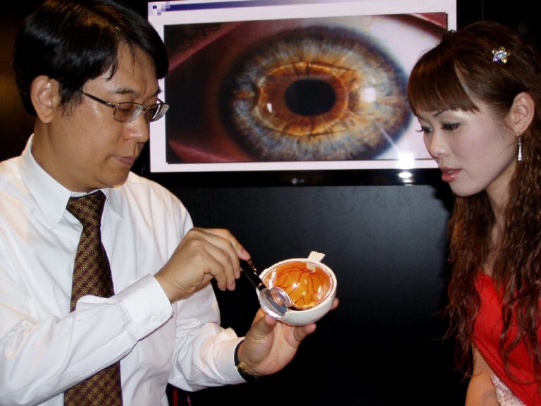 植入式隱形眼鏡手術  嘉惠高度近視族