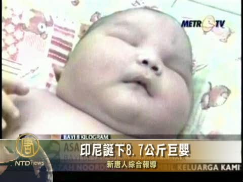 印尼誕下8.7公斤巨嬰