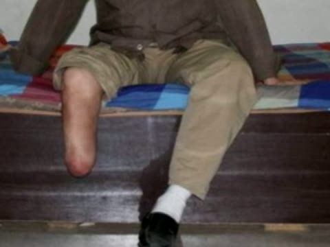 大陸傷殘軍人賣軍功章換生活費