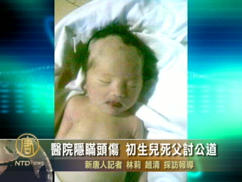 醫院隱瞞頭傷 初生兒死父討公道