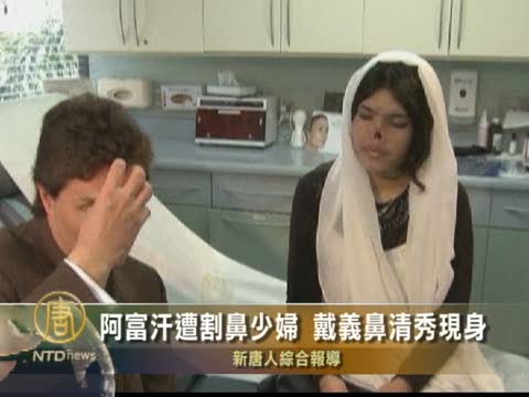 阿富汗遭割鼻少婦 戴義鼻清秀現身