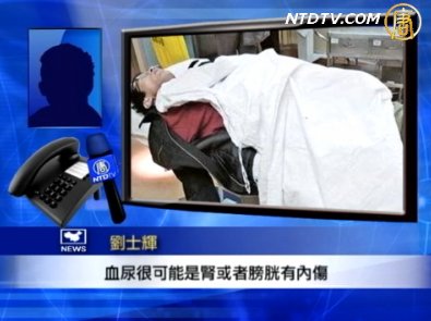 維權律師遇襲 暴徒叫囂打斷你狗腿
