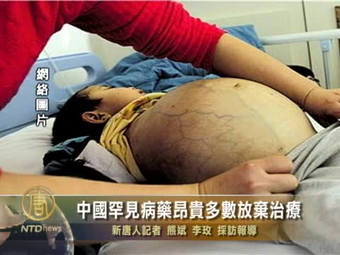 中國罕見病藥昂貴多數放棄治療