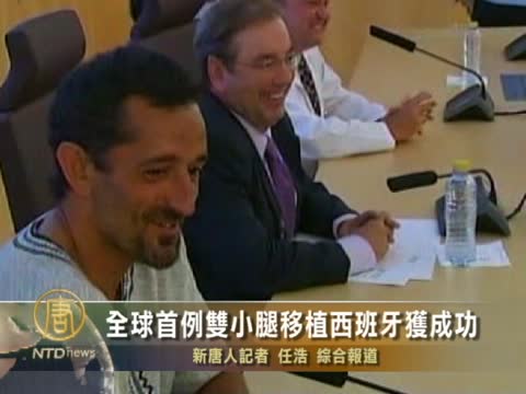 全球首例雙小腿移植西班牙獲成功