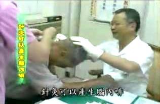 健康樂自在：針灸止痛
