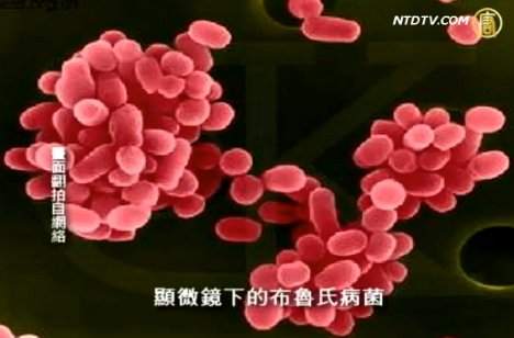 專家:感染布魯氏菌病重則影響生育