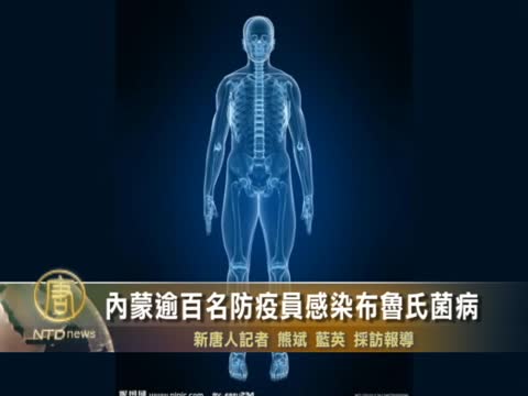 內蒙逾百名防疫員感染布魯氏菌病