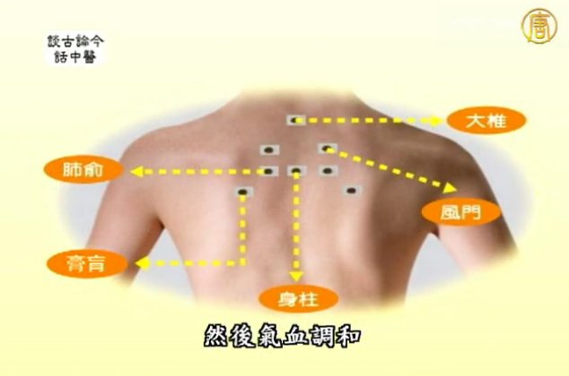 談古論今話中醫：認識三伏貼