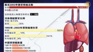 【石濤評述】中國器官移植數據背後的蹊蹺