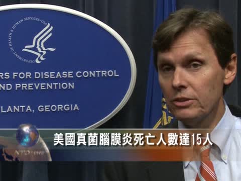 美國真菌腦膜炎死亡人數達15人