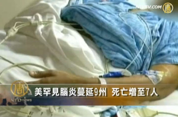 美罕見腦炎蔓延9州 死亡增至7人