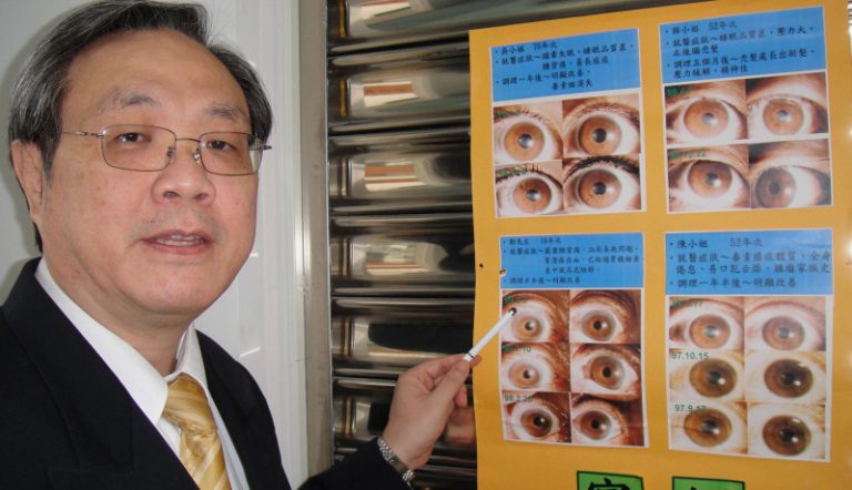 看虹膜評健康  獲國際醫學重視