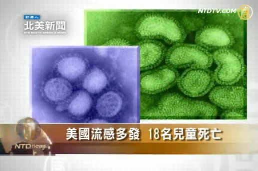 美國流感多發  18名兒童死亡