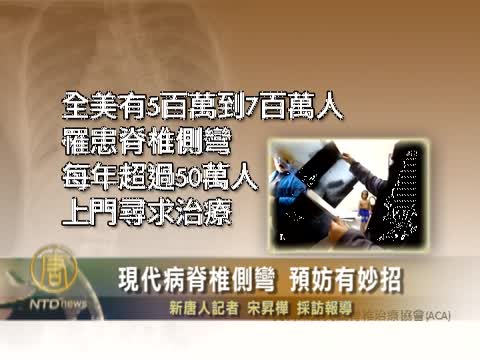 現代病脊椎側彎  預防有妙招