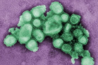 H7N9添兩例 湖南現可人傳人的H1N1