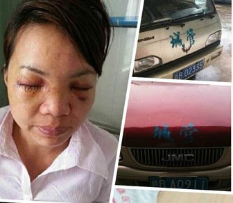 江西囂張城管 被爆打瞎路人揚言百萬元買命