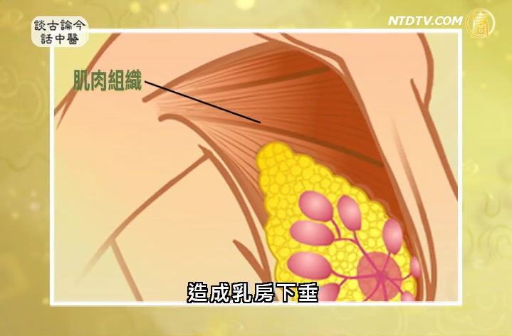 談古論今話中醫：中醫自然豐胸法