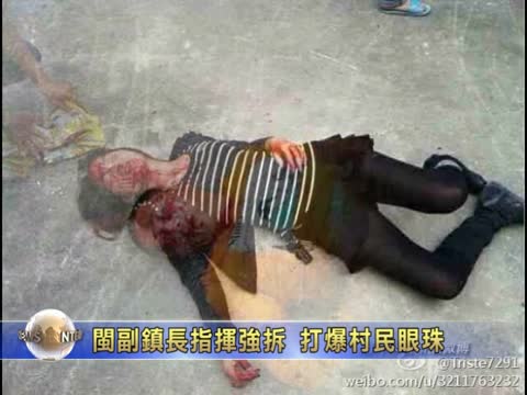 閩副鎮長指揮強拆 打爆村民眼珠