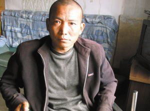 河北男子無錢手術自己鋸腿 咬掉四顆牙