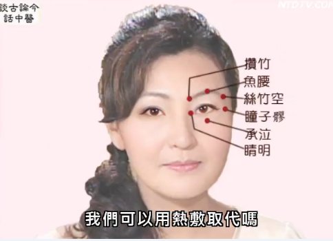 談古論今話中醫：用眼過度 當心眼中風