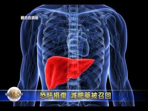 恐肝損傷  減肥藥被召回