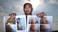 黑監獄案開庭 皖訪民揭遭燒紅鐵鉗烙身