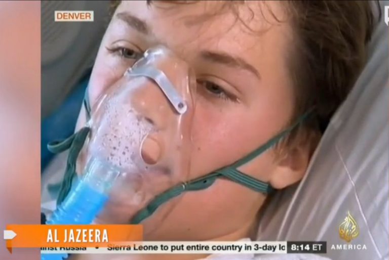 美爆發罕見腸病毒疫情 10州上千兒童染病