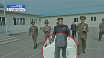 傳金正恩雙腳骨折又曝一機密 罪魁禍首居然是它？