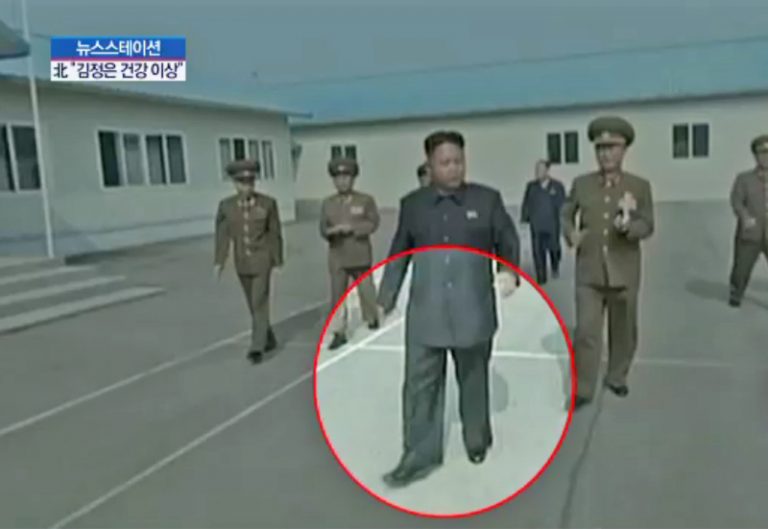 傳金正恩雙腳骨折又曝一機密 罪魁禍首居然是它？
