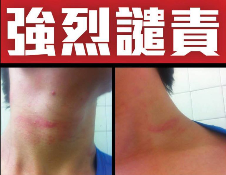 記者採訪被拉出暴打 SocREC譴責警方暴力