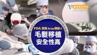 【廣告】毛髮移植＠麗秀整形外科