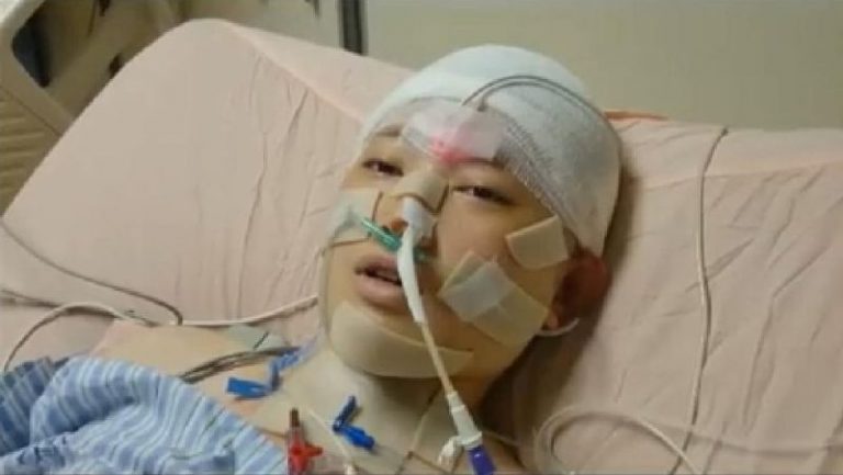 謝謝照顧我的人 唇膏妹動兩次手術「我都沒哭！」