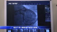 美公視播記錄片  指證中共活摘器官