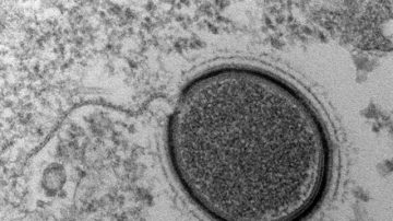 科学家拟唤醒沉睡3万年的巨大病毒