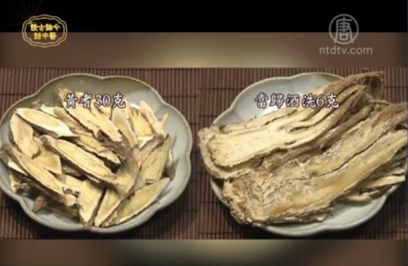 談古論今話中醫：醫聖張仲景特輯（10）