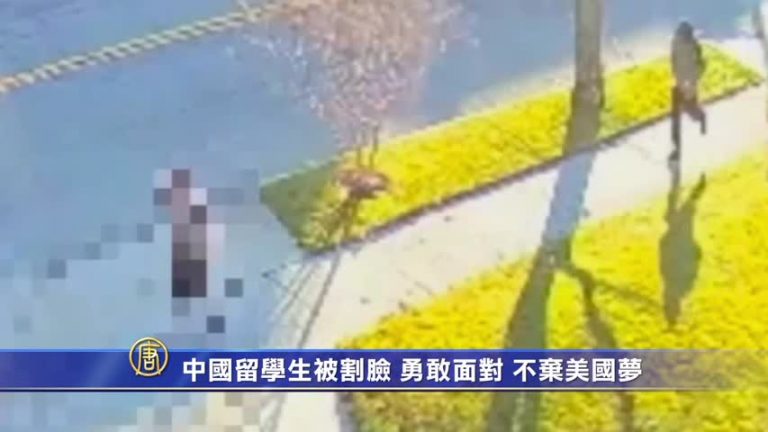 中國留學生被割臉 勇敢面對 不棄美國夢