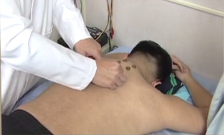 談古論今話中醫：冬病夏治三伏貼