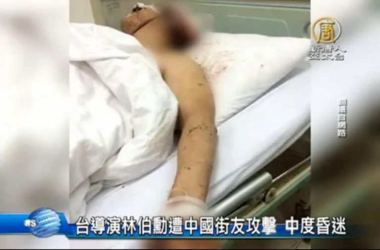 台導演林伯勳遭中國流浪漢攻擊 中度昏迷