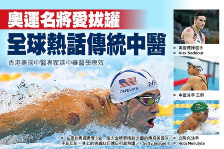 奧運名將愛拔罐 香港美國專家談中醫 療效著實驚人
