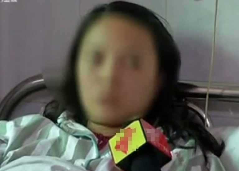 吃大閘蟹險丟命  廣州女感染橫紋肌溶解症