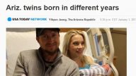 差11分钟 美双胞胎出生年分不一样