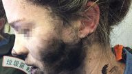 万米高空耳机突爆炸 离京澳洲女被炸伤