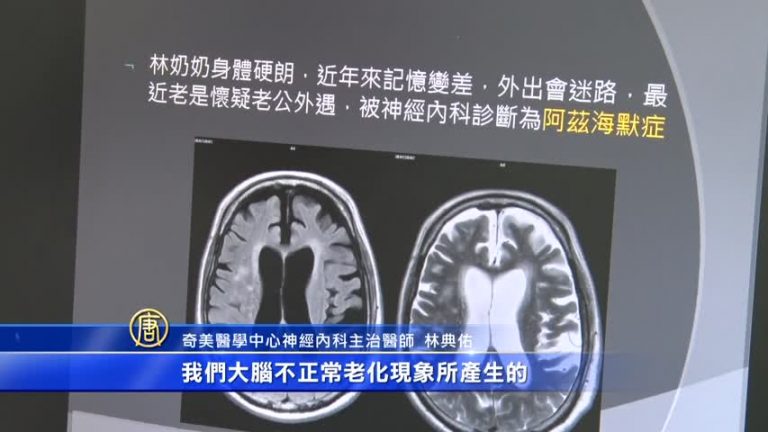 13位長者就有1人！台灣失智症預防受矚