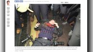 【禁聞】文在寅隨行記者 遭15名中共警衛暴打