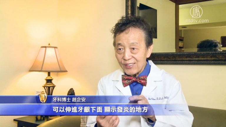 【工商】牙齒鬆動如何救 華人牙醫有妙招