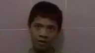 奇！印尼少年会下蛋  腹中蛋形X光片清晰可见