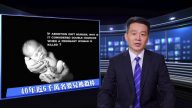 專家連線：美國傳統珍視生命 墮胎風氣受左派鼓動