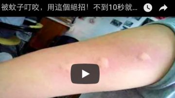 被蚊子叮咬，用这个绝招！不到10秒就止痒不留痕！