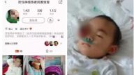狠母利用眼癌女兒籌善款治兔唇兒子 任女慘死